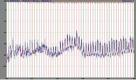 Spectre : peigne de raies en analyse vibratoire